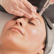 microneedling-treatment-page_edited